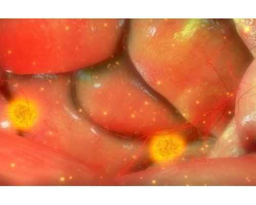 重庆专业做代怀,重庆试管婴儿排名好的有谁？-上海供卵试管机构有哪些_做了试