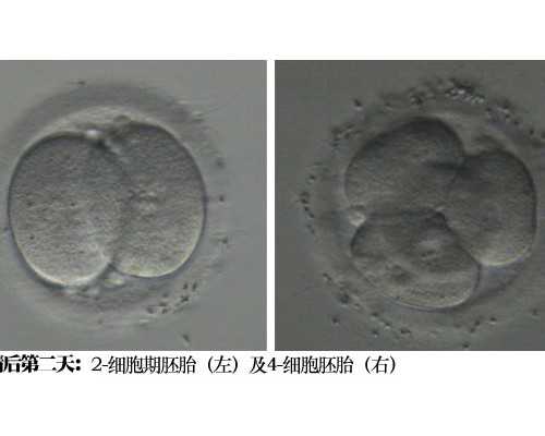 多囊患者如何备孕