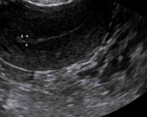 重庆有代生公司吗,重庆买精子库的精子好多钱,重庆精子库的精子质量如何