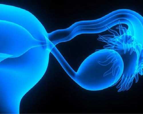 患上多囊卵巢综合症做什么检查呢？~助孕机构费用价格