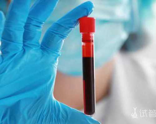 重庆代怀公司真假,做重庆助孕试管婴儿前去医院必看这三项指标！_上海有供卵